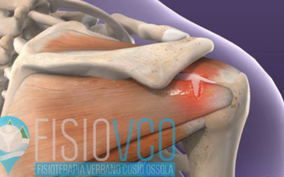 Trattamento delle problematiche di spalla